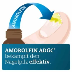 Outlet ADGC Amorolfin 50 mg / ml wirkstoffhalt.Nagellack, 3 ml