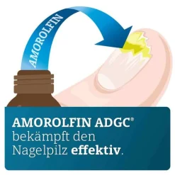 New ADGC Amorolfin 50 mg / ml wirkstoffhalt.Nagellack, 5 ml