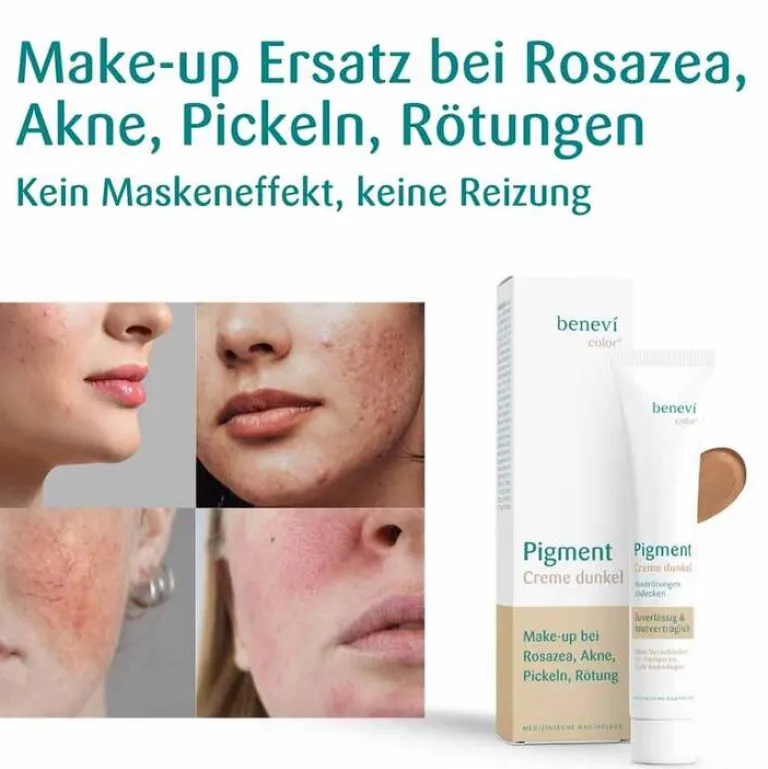 New Color Pigmentcreme dunkel, 20 ml Make Up|Pigmentflecken