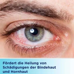 Hot Augen- und Nasensalbe zur Förderung der Wundheilung, 10 g Nasensalbe|Augensalbe