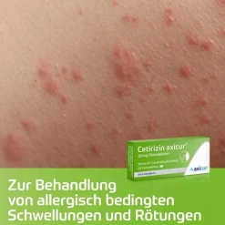 Hot axicur Cetirizin ® 10 mg Filmtabletten, 100 St