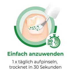 Sale gegen Nagelpilz, 6.6 ml Nagelpilz Lack