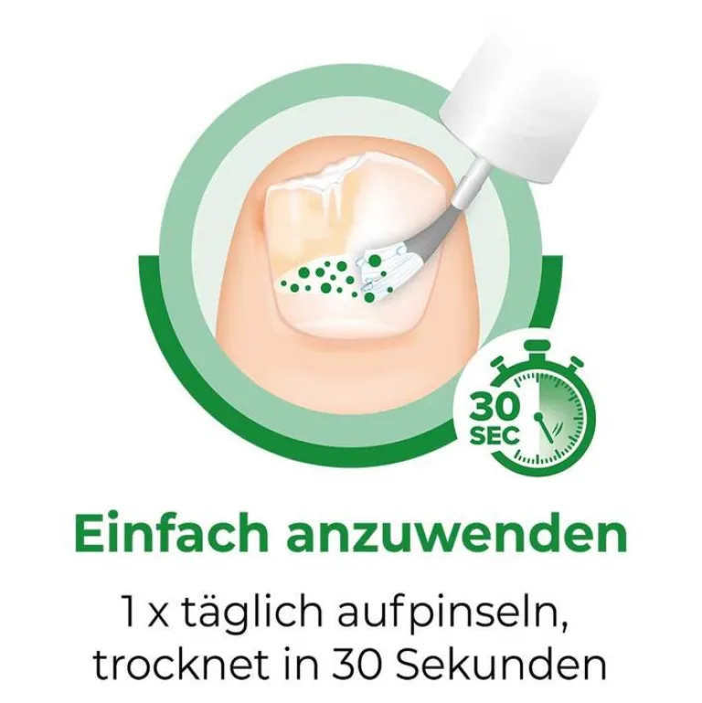 Sale gegen Nagelpilz, 6.6 ml Nagelpilz Lack