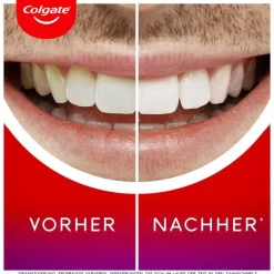 Best Colgate Max white Overnight whitening Serum, 2.5 ml