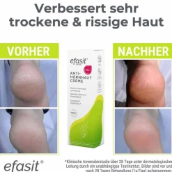 Efasit Anti-Hornhaut Creme, 75 ml