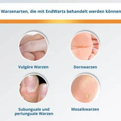 Outlet ® Pen F, 3 ml Warzenstift