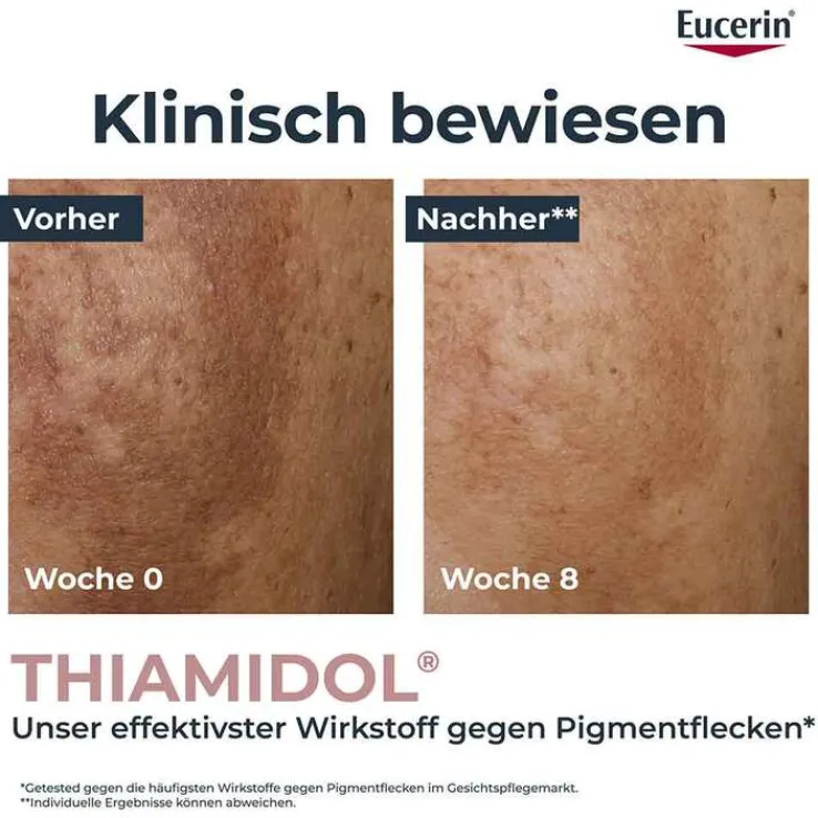 Eucerin Anti-Pigment Teint perfektionierendes Serum, 30 ml