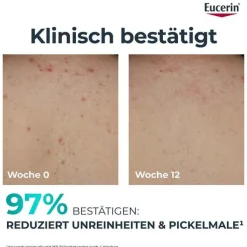 Eucerin Dermopure Clinical Körperpflege erneuernd, 200 ml