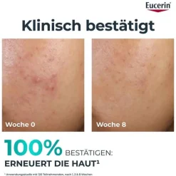 Eucerin Dermopure Clinical Peeling 10 Nachtcreme, 40 ml