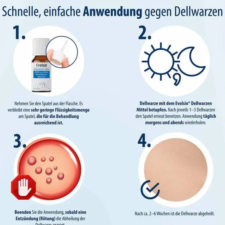 Evolsin Dellwarzen Mittel Lösung, 5 ml