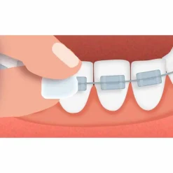 Best Orthodontisches Wachs, 1 St Geräte & Zubehör