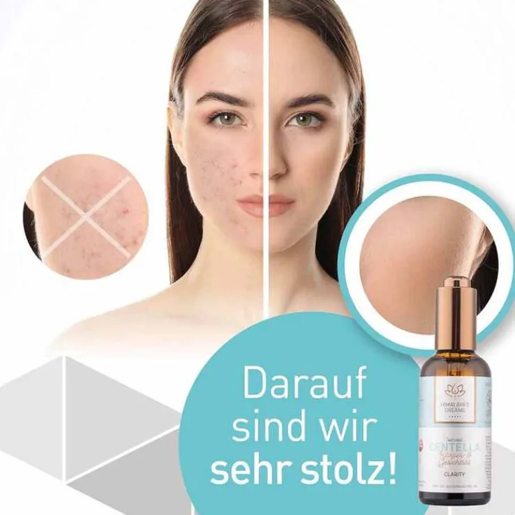 Himalayas Dreams Ayurveda Körper & Gesichtsöl Centella, 100 ml