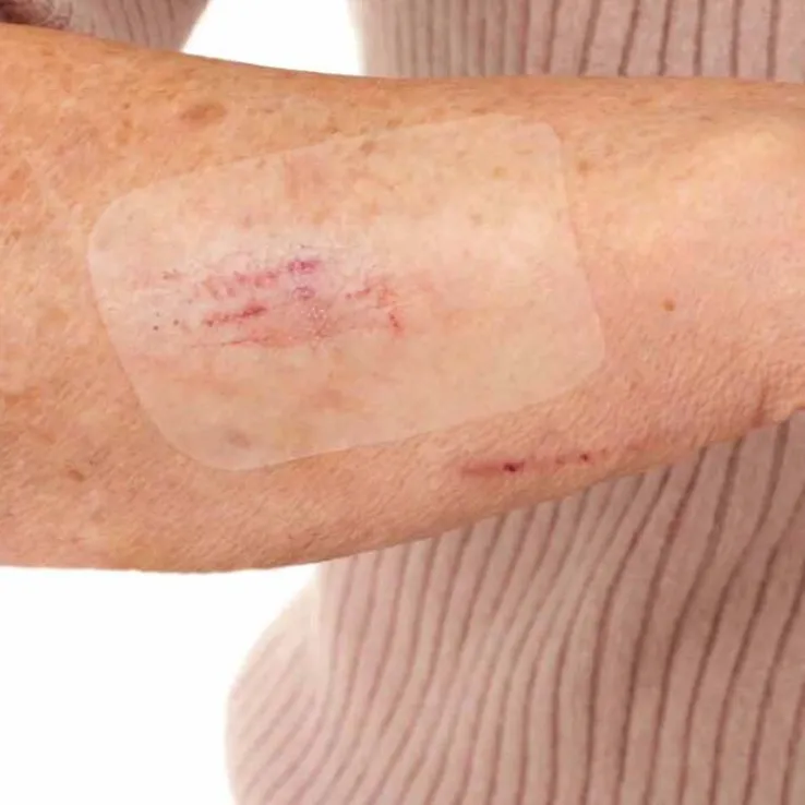 Leukomed® T skin sensitive 8x10 cm, 5 St