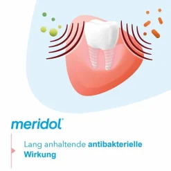 Sale Rundumpflege Mundspülung, 400 ml Mundspülung