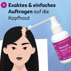 Clearance Dexcel Minoxidil 20 mg / ml Spray z.Anw.a.d.Kopfhaut, 3X60 ml