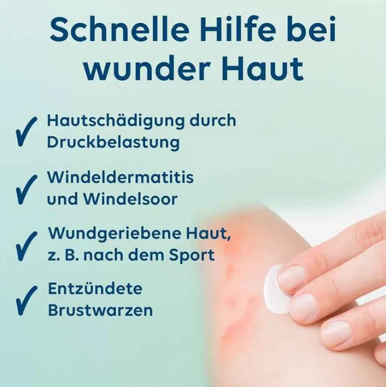 Online Heilsalbe mit Nystatin und Zinkoxid, 25 g Kinder Haut|Zinksalbe