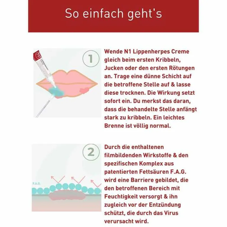 N1 Lippenherpes Creme, Packungsgröße 4 g, 2 g Lippenherpes