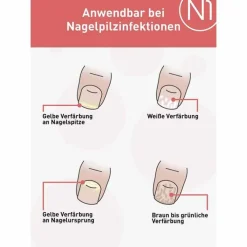 Best N1 Nagelpilz Lösung, 10 ml