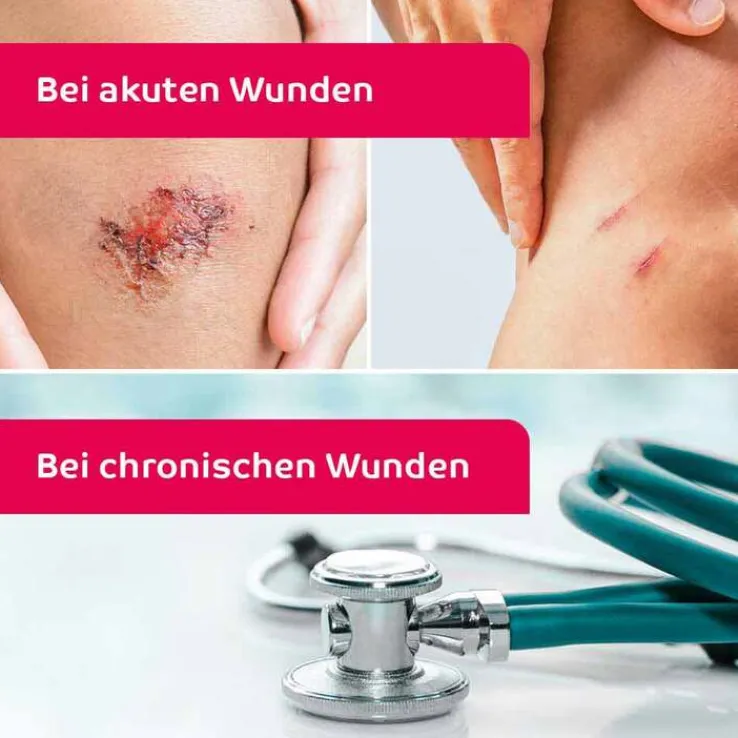 octenisept Wund-Desinfektion Spray mit Sprühpumpe, 50 ml