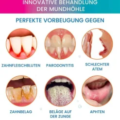 Oroxid Forte Mundspray, 100 ml