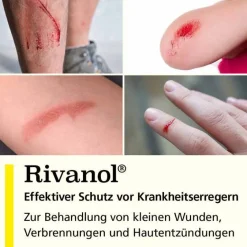 Hot Lösung 0,1 %, 500 ml Mittel Bei Mückenstichen|Wund- & Heilsalbe