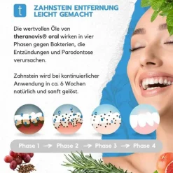 Sale Theranovis oral Zahnstein Gel, 120 ml