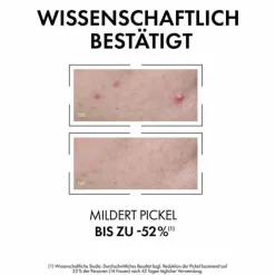 Hot Normaderm Anti-Unreinheiten Serum, 30 ml Unreine Haut|Serum & Kur