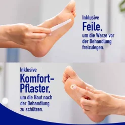 Clearance Wartner Fußwarzen Spray, 50 ml