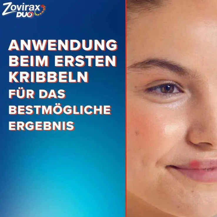 Zovirax® DUO Creme bei Lippenherpes. 5 % Aciclovir, 1 % Hydrocortison, 2 g